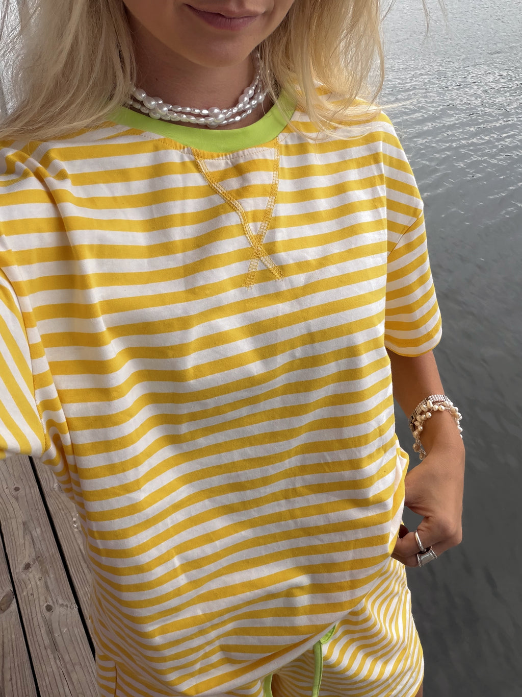 Yellow & White Stripe Short Set